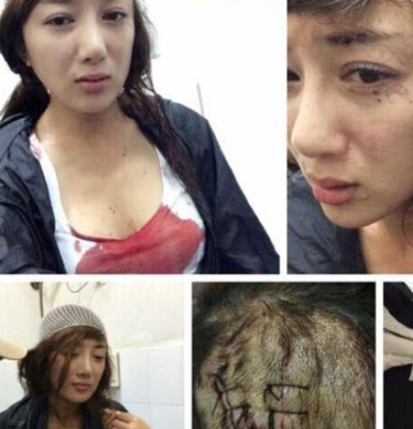 叶璇经纪人述宠物狗伤人始末