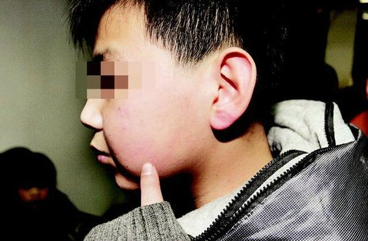多名小学生因“没考90分”被老师抽耳光