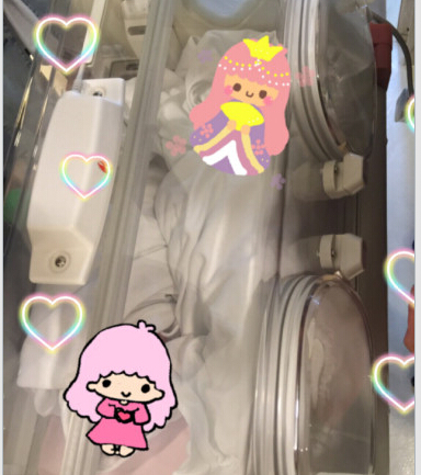 甘薇产双胞胎女儿