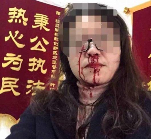 苏州大学女教师在交警中队被打断鼻梁