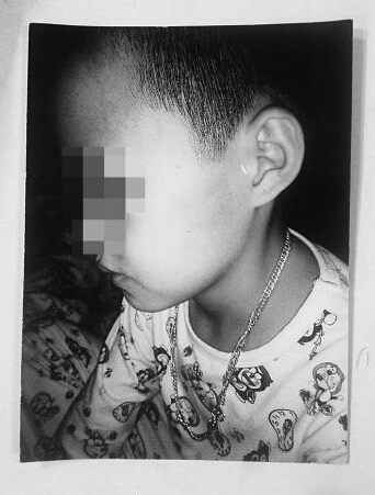 海南一小学生上课借笔 被老师一巴掌打肿脸