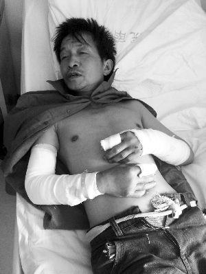 藏獒挣脱铁链连咬两人 男子为保命倒地装死