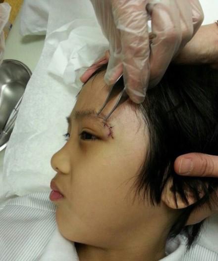 吴镇宇痛心费曼眼角永久伤害 发飙斥《爸爸》节目组不作为