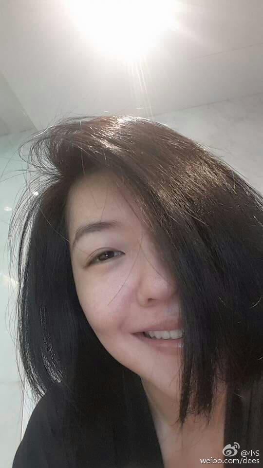 小S晒素颜照证伤愈 急盼复工：我要开黄腔