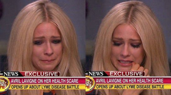 艾薇儿患莱姆病曾崩溃 竟因为夏天被蜱虫叮咬