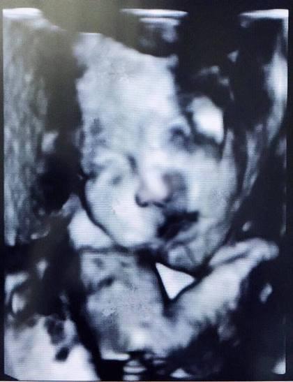 40岁徐若瑄怀孕满32周 晒肚里宝宝正面轮廓照