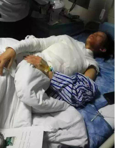 哺乳期妈妈吃火锅要求加汤 服务员将滚汤浇其头上