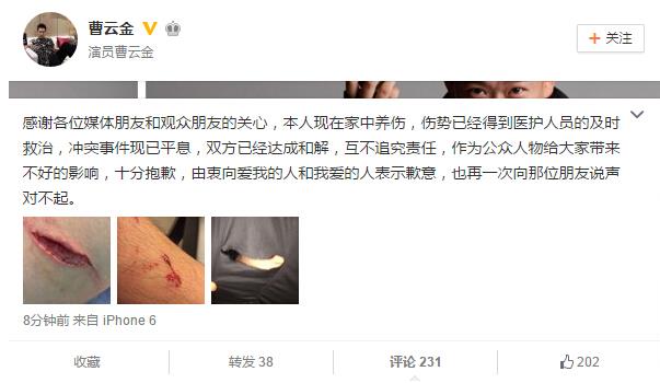 曹云金亲述抡椅子打群架斗殴实情 晒伤口道歉遭吐槽