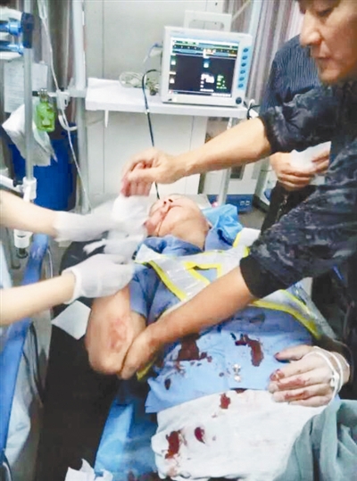 “拐的”司机暴力抗法 交警被撞倒后遭碾压至今昏迷