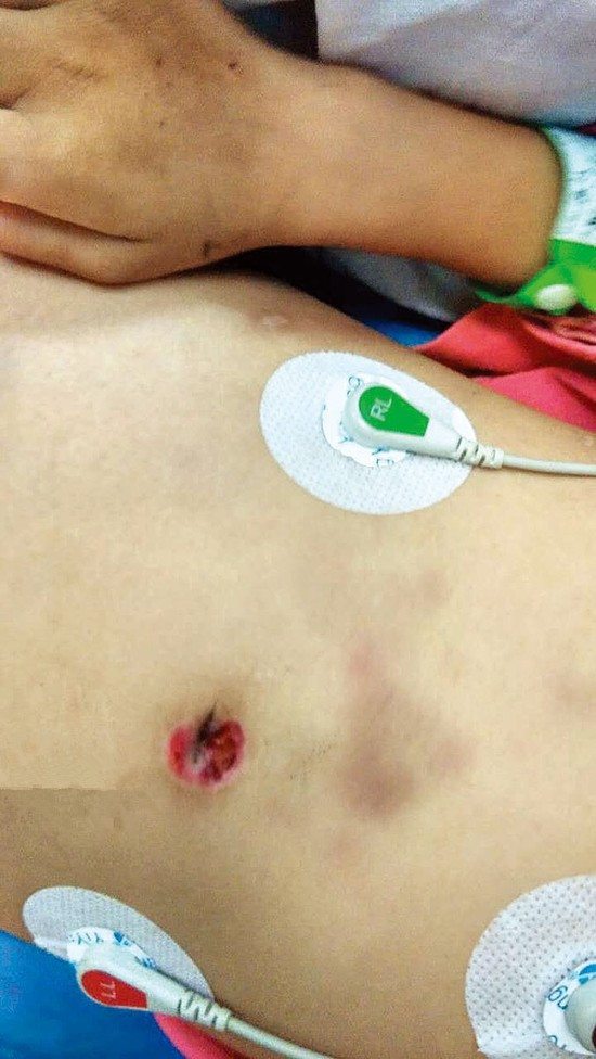 7岁女童病危下体撕裂或遭性侵 姑父与其耳语被指可疑