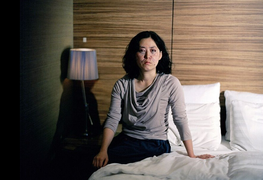 韩国医院内整容后的女人